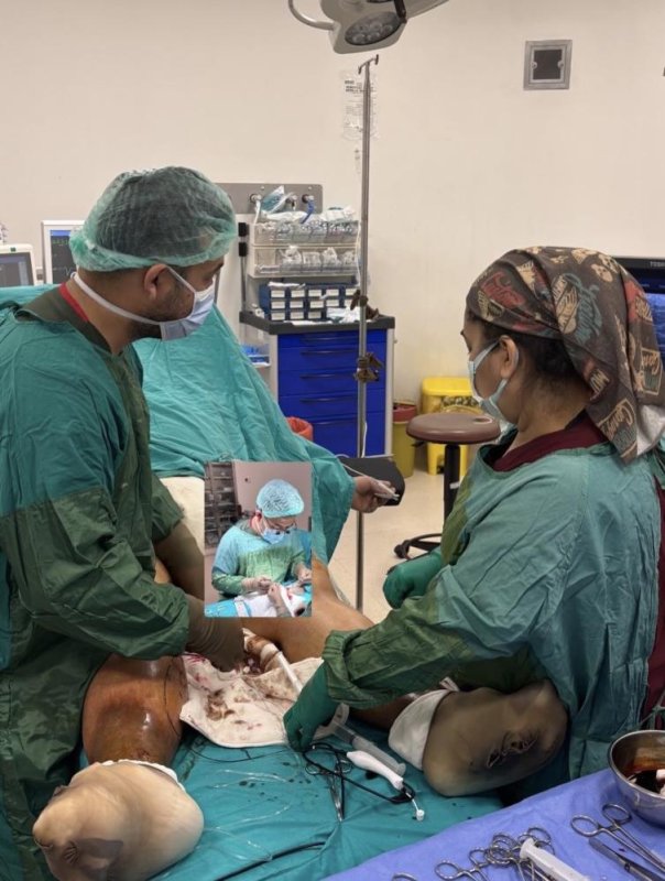 Tarsus’ta Bir İlk: Varis Tedavisinde RF Ablasyon