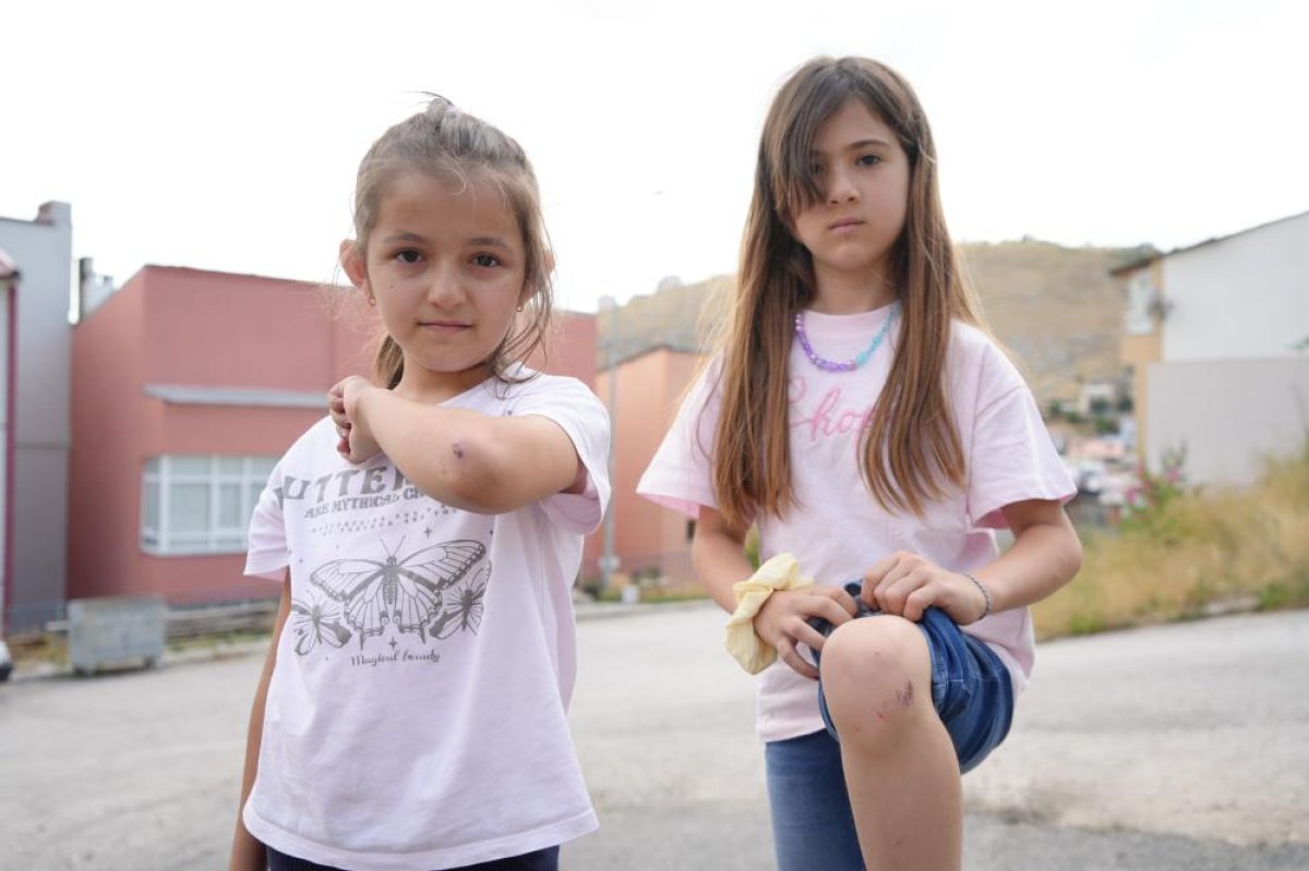 Bayburt'a tatile gelen iki kuzen köpeklerden kaçarken yaralandı