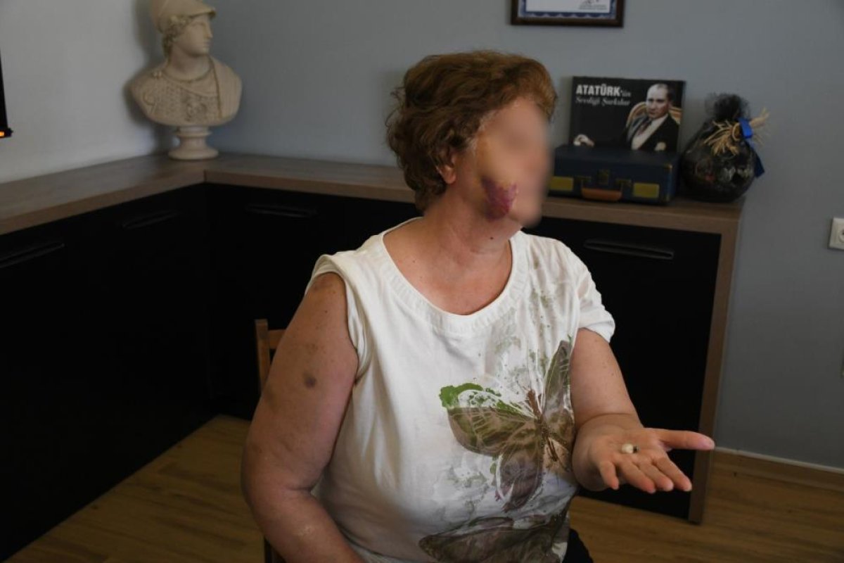  Kuşadası'nda ev kavgası kanlı bitti: Anne ve iki çocuğu bıçaklandı
