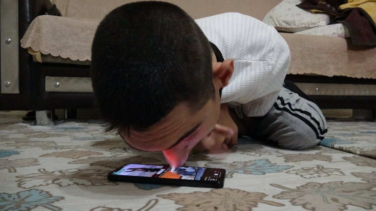 Engelleri burnuyla aştı: Telefonuyla hayata tutundu