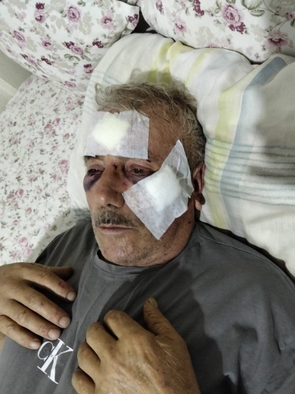 68 yaşındaki adamı muştayla darp etti
